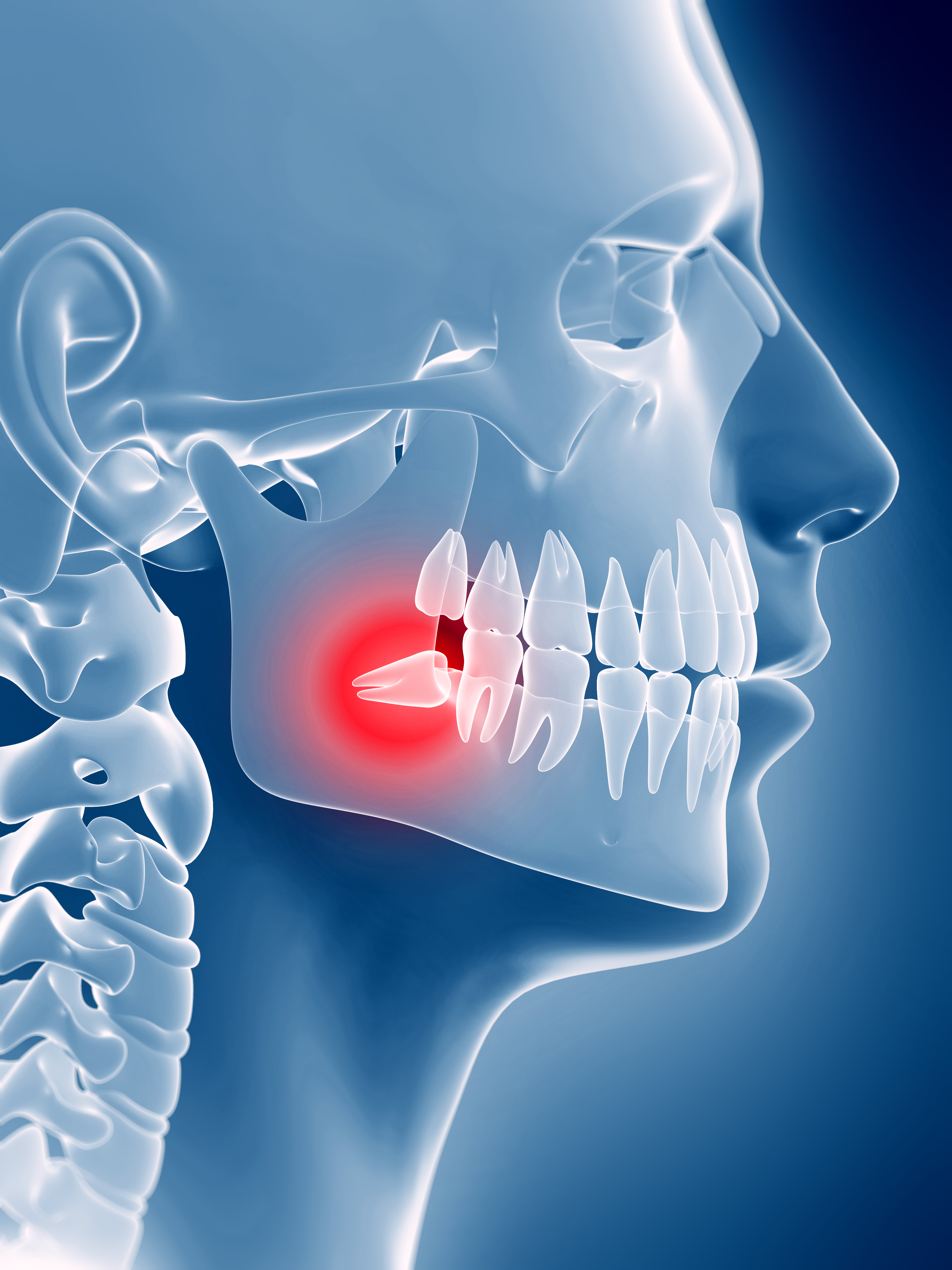3D dental X-ray skull